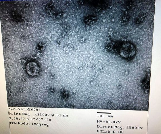 Hình ảnh virus Corona được phân lập, nuôi cấy thành công tại Viện Vệ sinh dịch tế Trung ương