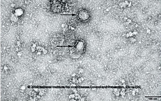 新型冠狀病毒在顯微鏡下的圖片。（圖源：新華社）