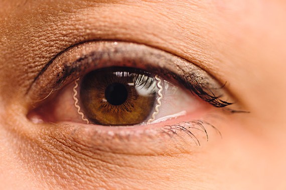 美科學家研發24小時追蹤眼壓智能隱形眼鏡