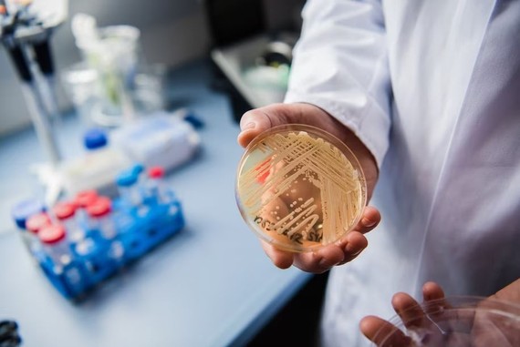 德国维尔茨堡实验室中的培养皿中含有耳念珠菌。（图：Getty Images）