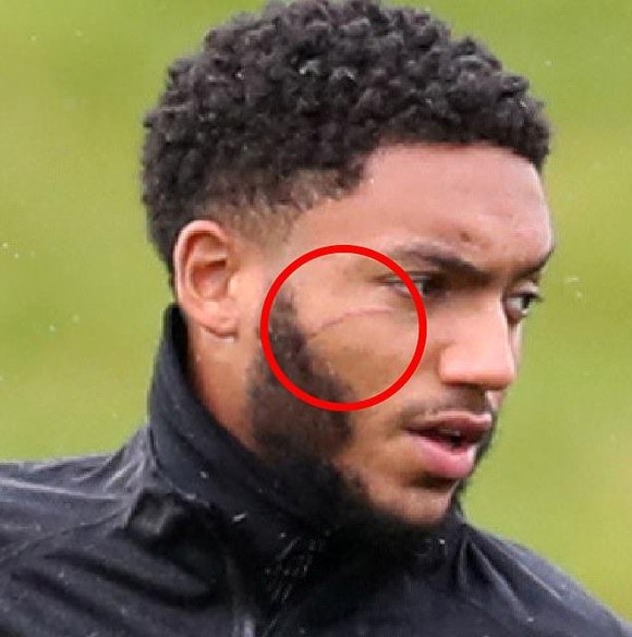 Tuyển Anh gạt Sterling khỏi đội hình vì đánh sưng mặt Joe Gomez ảnh 1