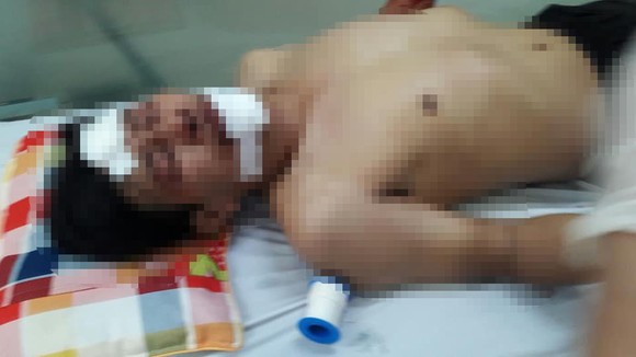 Bắt giữ nghi phạm giết người ở thị xã Hồng Lĩnh sau 8 giờ lẩn trốn ảnh 4