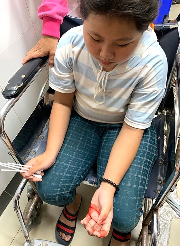 Cháu bé nhà nghèo, mắc bệnh “mồ hôi máu” ảnh 1