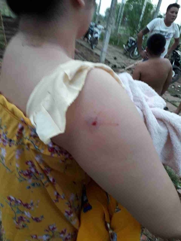 Cả gia đình bị nhóm 'giang hồ' dùng súng, hung khí đe dọa ảnh 5