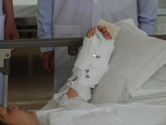 Dự tiệc tất niên, một phụ nữ bị chém đứt lìa cánh tay ảnh 2