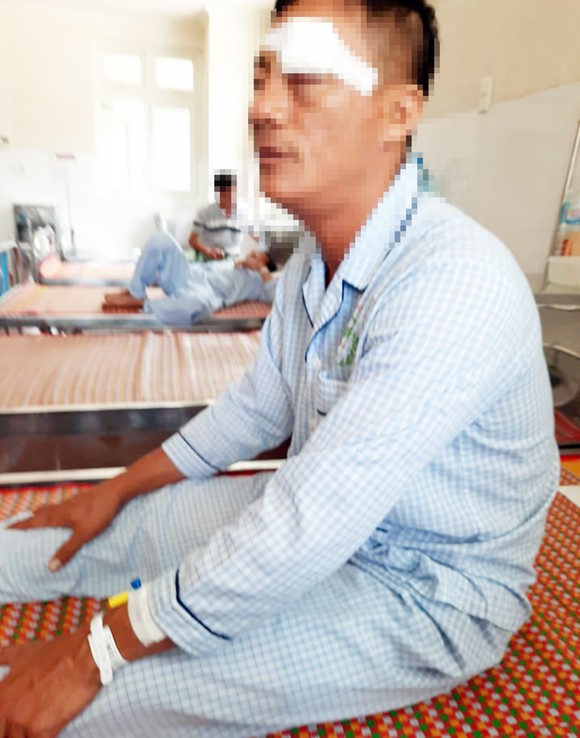 Mâu thuẫn ở bến xe Quy Nhơn, phụ xe bị bắn vào mắt ảnh 1