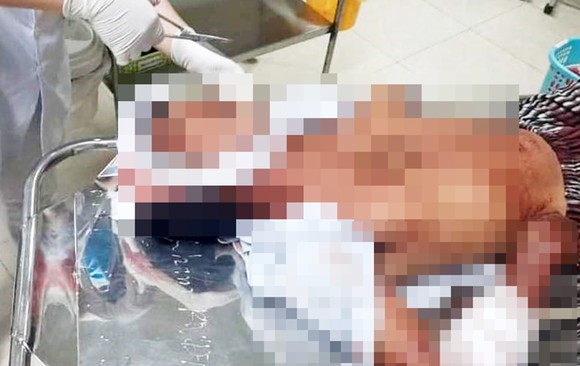 Con rể cầm rựa chém trọng thương cha và anh vợ ảnh 1