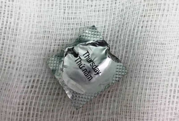 Bệnh nhân nuốt viên thuốc còn nguyên vỏ đâm vào thực quản ảnh 1