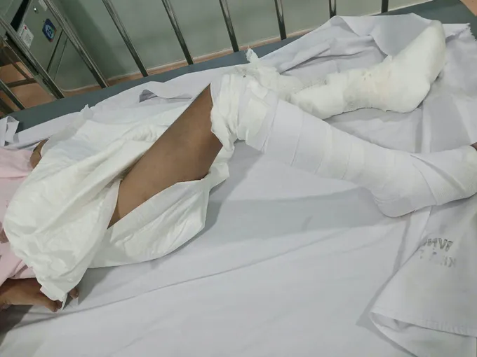 Cháu K. nằm điều trị ở bệnh viện e103392eda9f7cc1258e.jpg