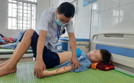 北寧省安豐縣醫療中心的一名醫生在為T.Q.D病童檢查傷勢。（圖源：銀英）