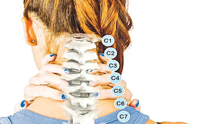 Giảm chất lượng cuộc sống do thoái hóa cột sống cổ ảnh 2
